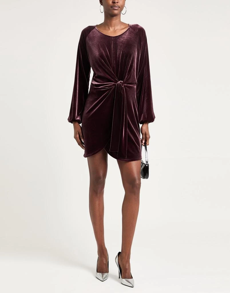 SOALLURE Short dress 2