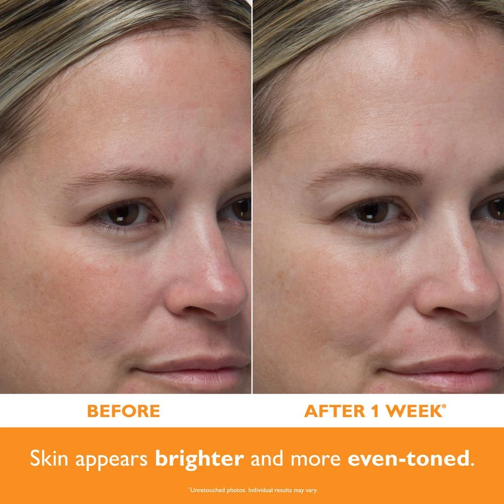 Peter Thomas Roth Potent-C Power Serum|30 ml / 1.0 fl oz 3