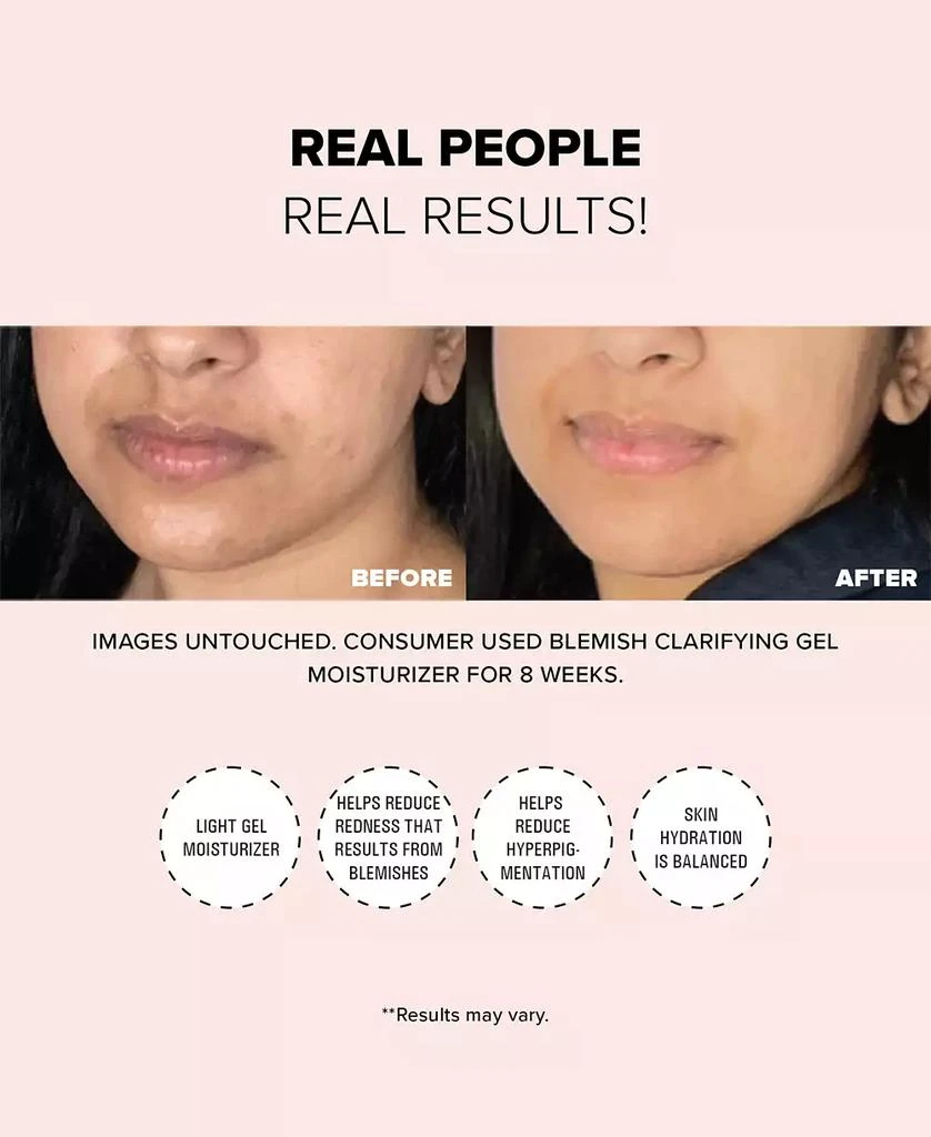NUDESTIX Nudeskin Blemish Clarifying Gel Moisturizer 8