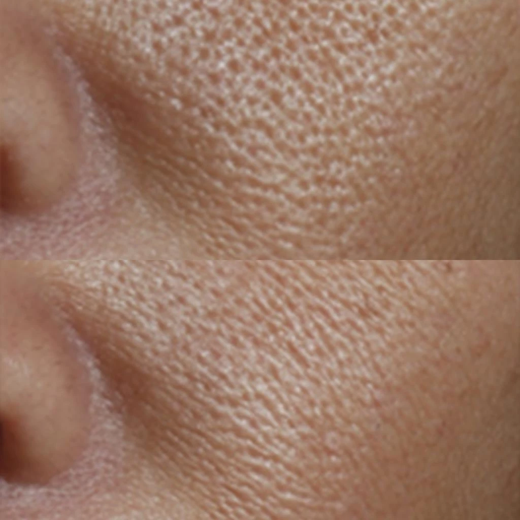 Perricone MD No:Rinse Intensive Pore Minimizing Toner 4