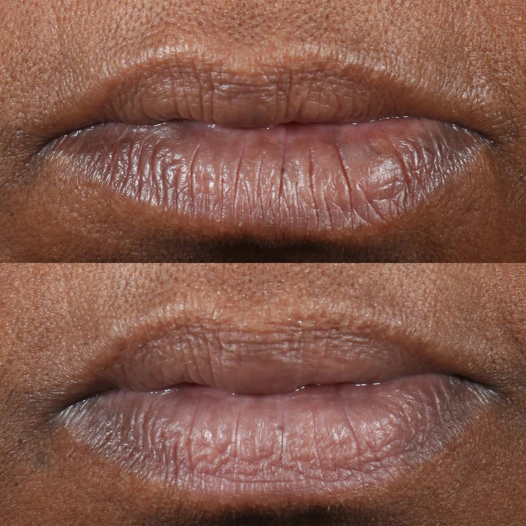 Perricone MD Cold Plasma Plus+ Lip Therapy 3