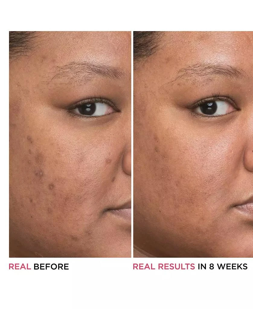 IT Cosmetics Bye Bye Dark Spots 4% Niacinamide Concentrated Derma Serum 2