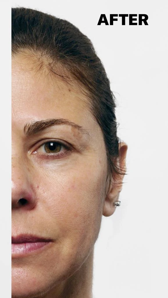 Murad Rapid Collagen Infusion Serum 4