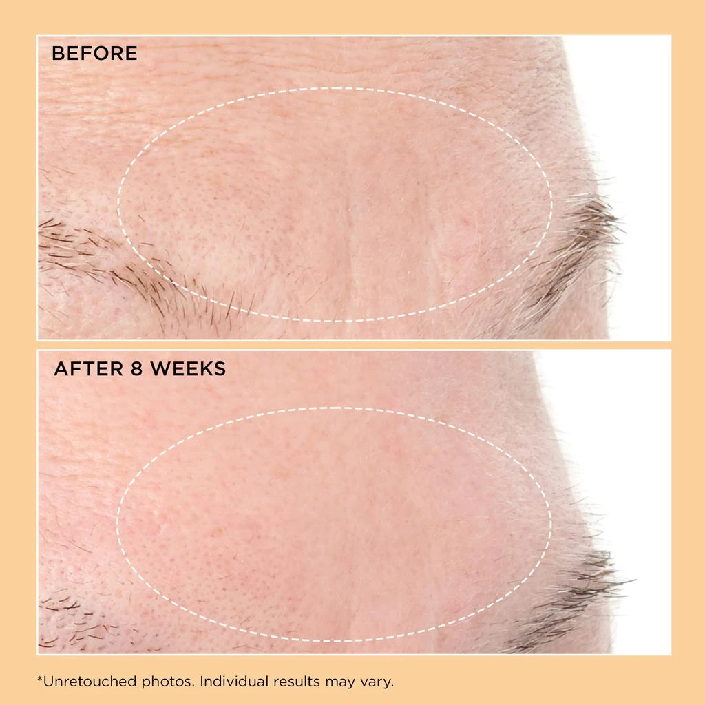 Perricone MD Neuropeptide Deep Crease Serum 4