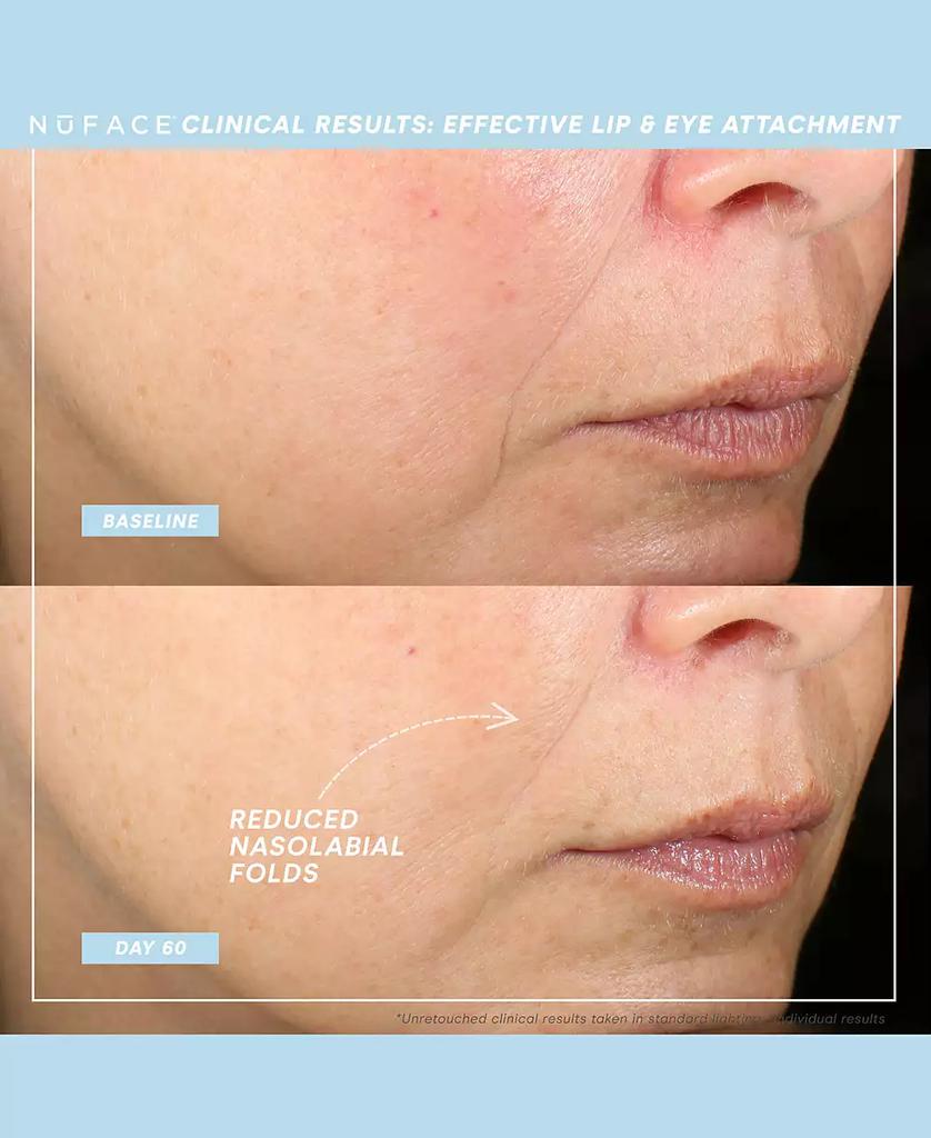 NuFace Effective Lip & Eye Attachment