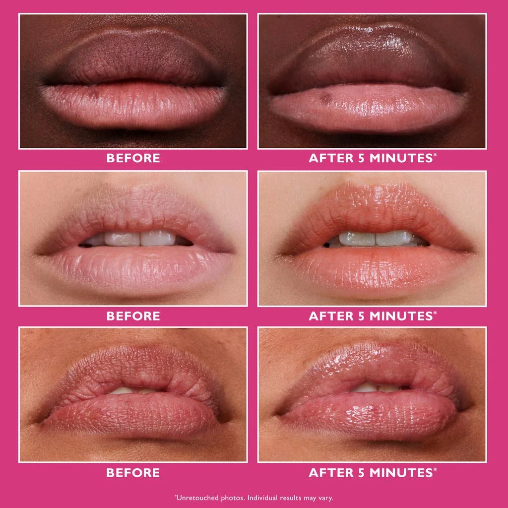 Peter Thomas Roth Instant FIRMx Lip Filler|10 ml / 0.3 fl oz 3