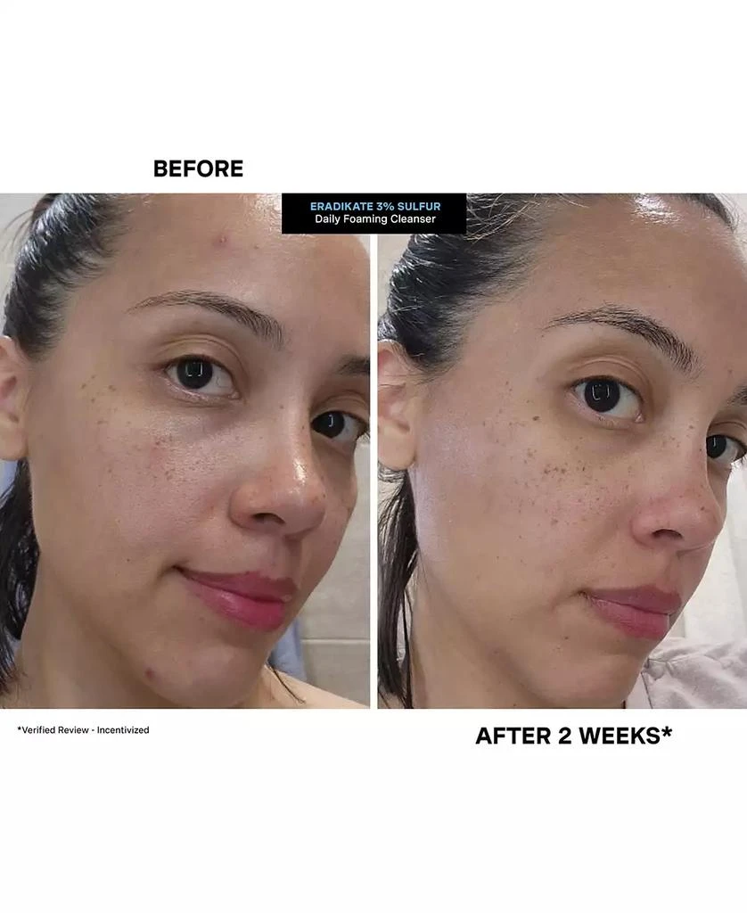 Kate Somerville EradiKate Daily Foaming Cleanser Mini 6