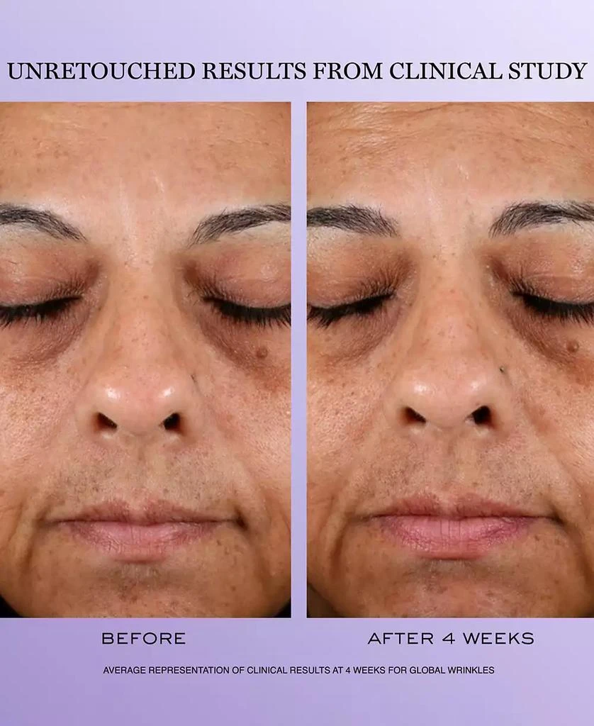 Lancôme 3-Pc. Rénergie H.C.F. Triple Serum Discovery Set 4