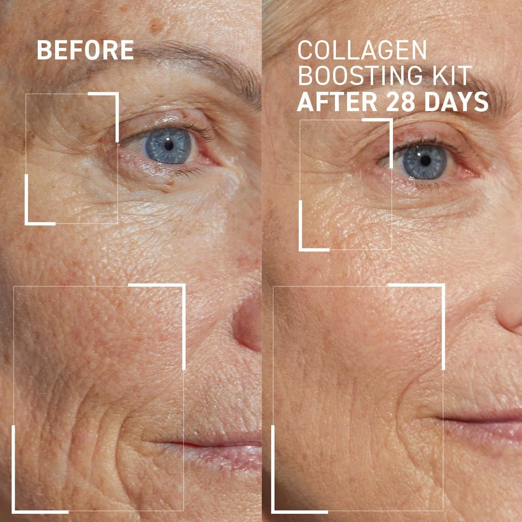 Dr. Brandt Skincare COLLAGEN CONTROL KIT 3