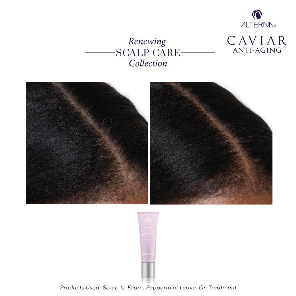 ALTERNA Alterna Renewing Scalp Care Peppermint Leave-on Treatment 2.5 oz 4