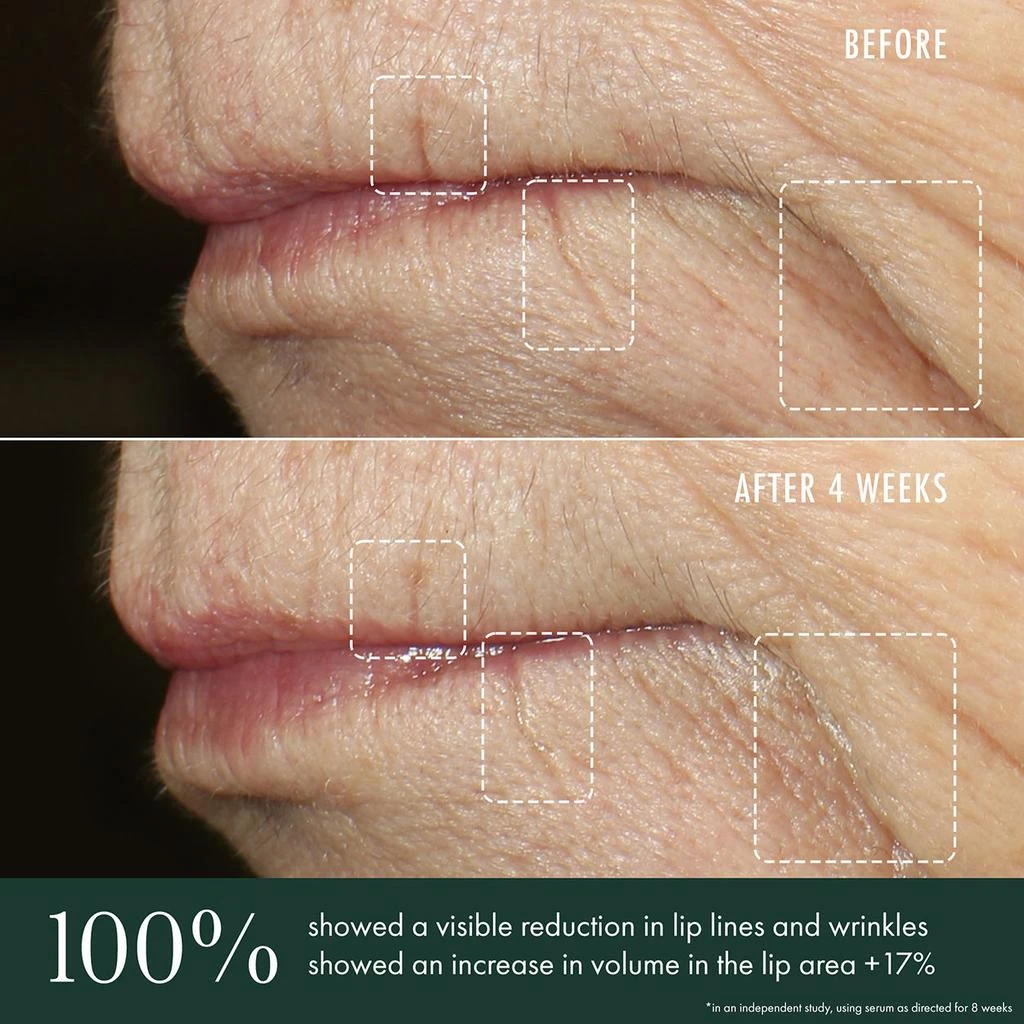 Revive Advanced Lip Perioral Serum Targeted Vertical Line Filler 3