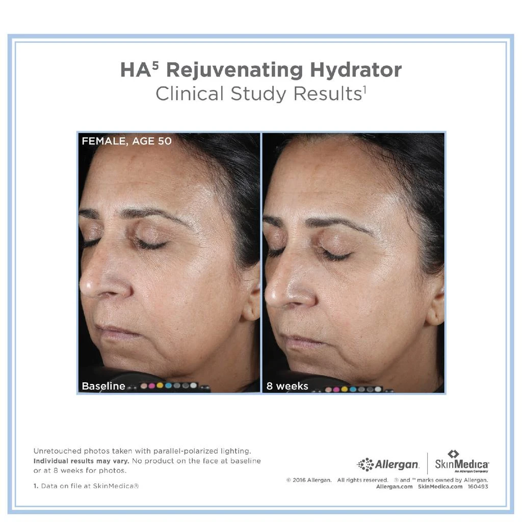 SkinMedica SkinMedica HA5 Rejuvenating Hydrator 3