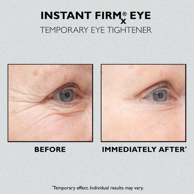Peter Thomas Roth Instant FIRMx Eye Temporary Eye Tightener 3