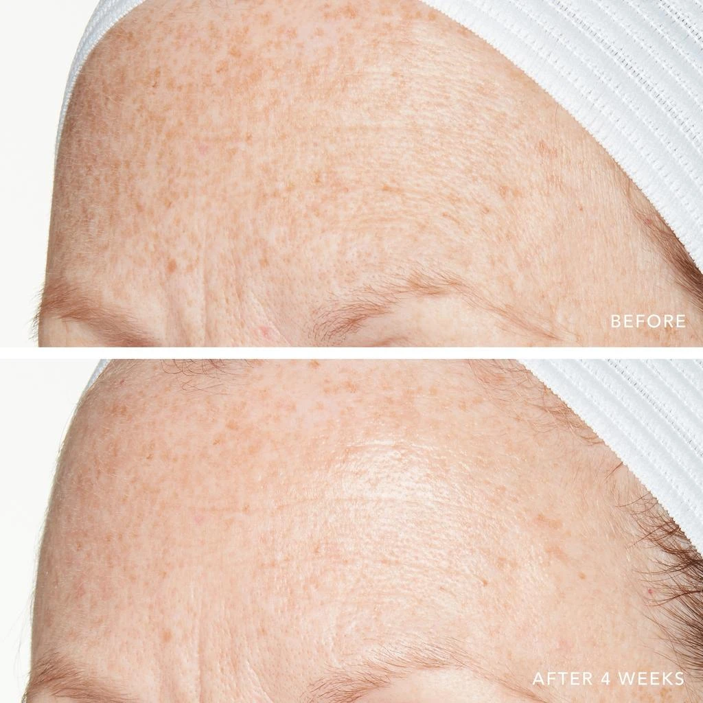 Lancer Skincare Lancer Skincare Advanced Retinol Treatment with 1.25 Retinol 8