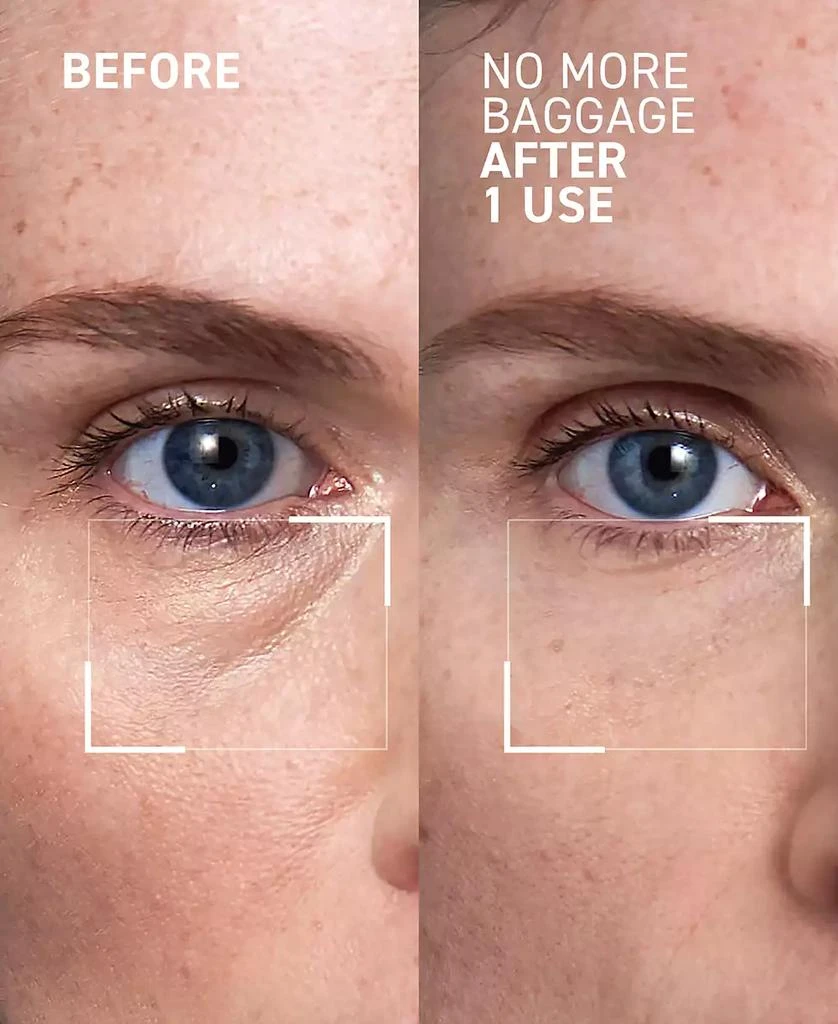 Dr. Brandt Skincare No More Baggage Eye De-Puffing Gel, 0.5-oz. 3