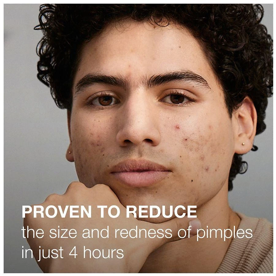 Neutrogena Stubborn Acne AM Treatment with Benzoyl Peroxide Fragrance-Free 9