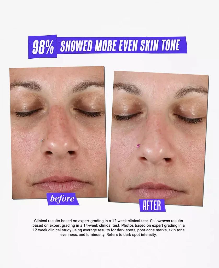Kiehl's Dermatologist Solutions Clearly Corrective Dark Spot Solution, 3.8 oz. 8
