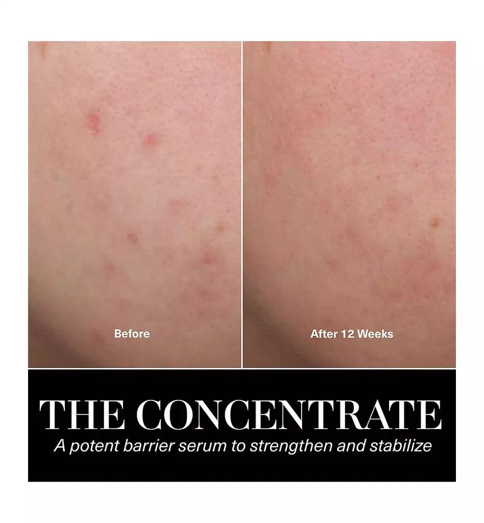 La Mer The Concentrate, 1 oz. 6