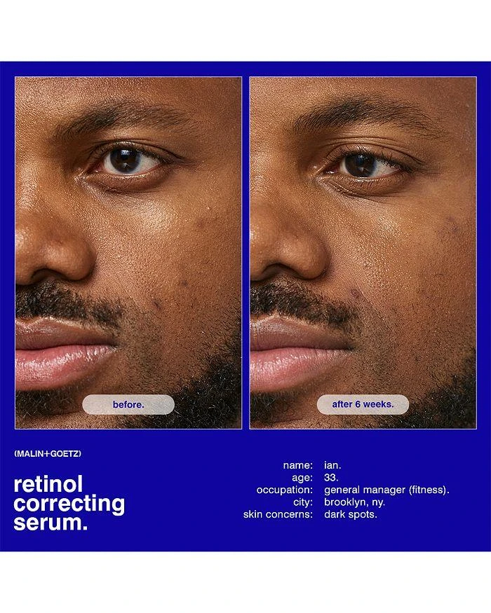 Malin + Goetz Retinol Correcting Serum 1 oz. 6
