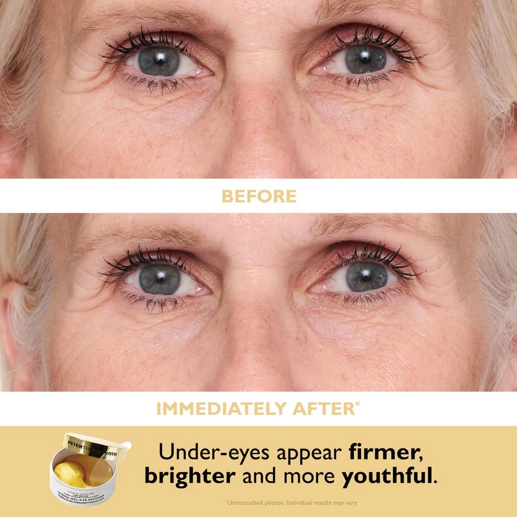 Peter Thomas Roth Patch + Go Eye Patch Travel Pack 4