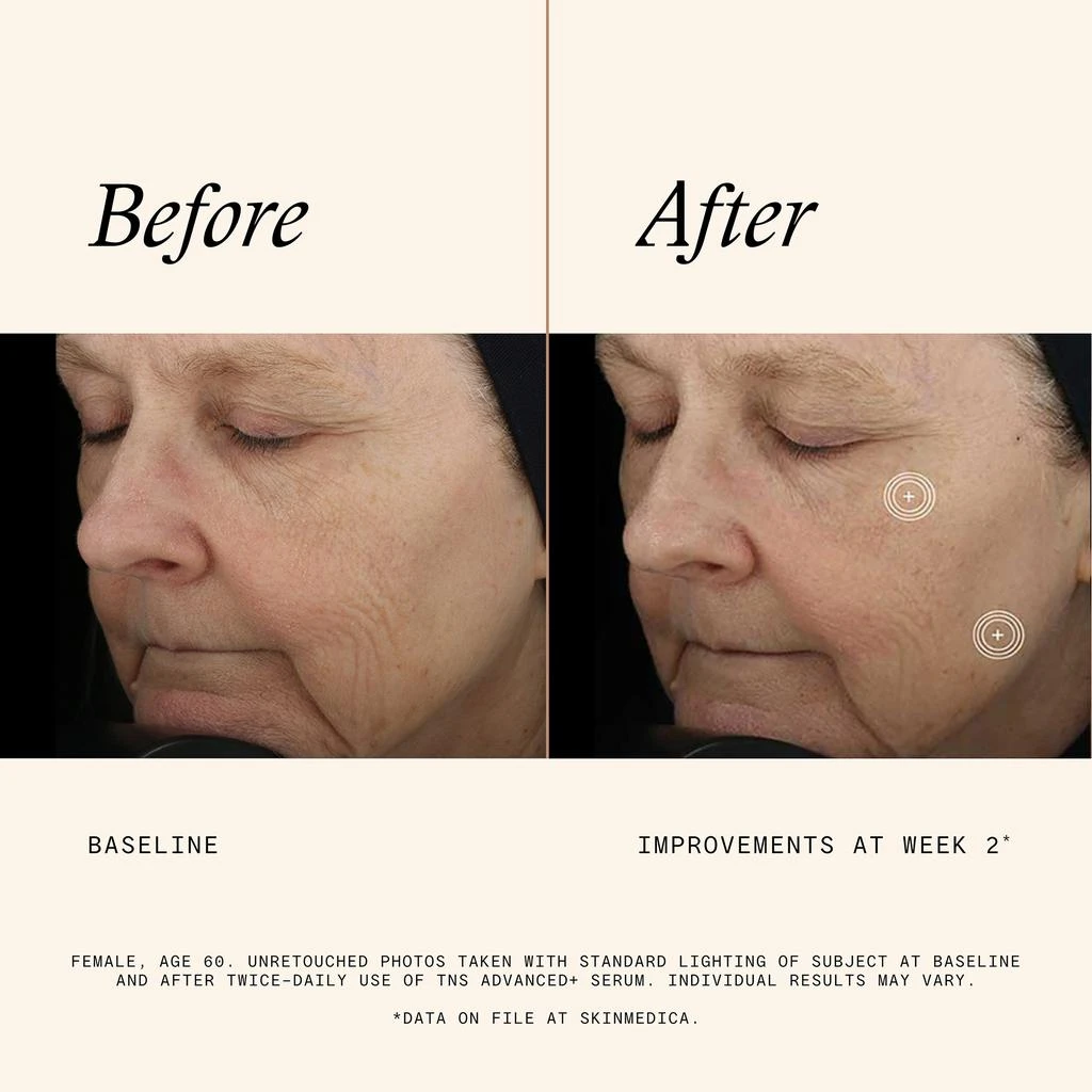 SkinMedica SkinMedica TNS Advanced+ Serum 3