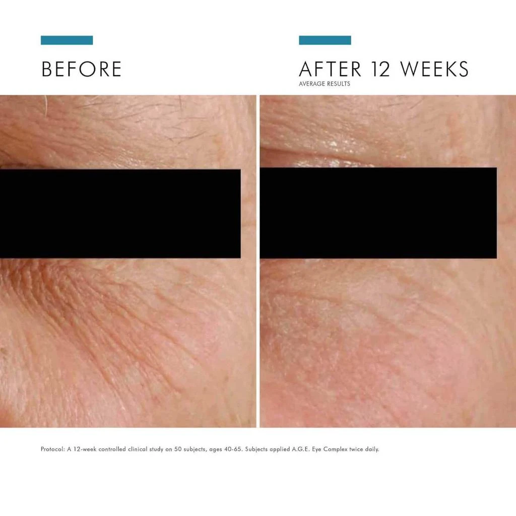 SkinCeuticals SkinCeuticals A.G.E. Eye Complex Wrinkle Eye Cream 5