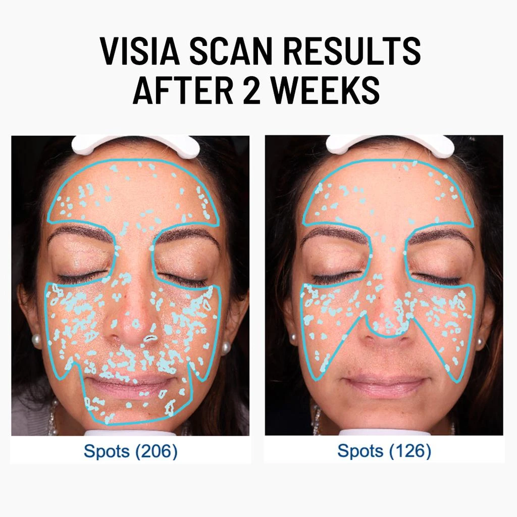 Dr. Brandt Skincare Advanced Face Exfoliator 5