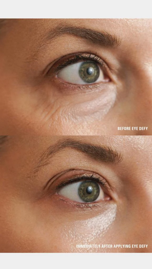 Goldfaden MD Eye Defy Radiance Restoring Eye Cream 3