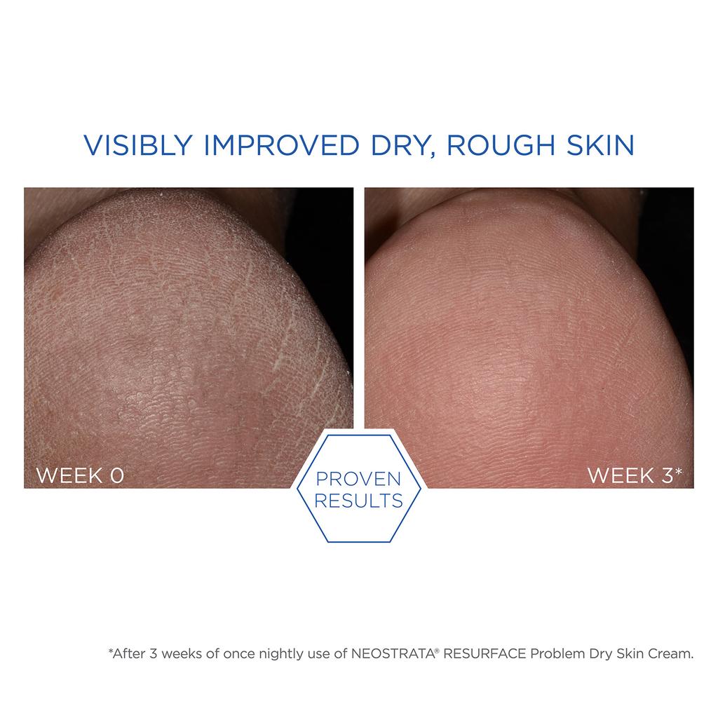 NeoStrata NEOSTRATA Resurface Problem Dry Skin Cream, 100 g