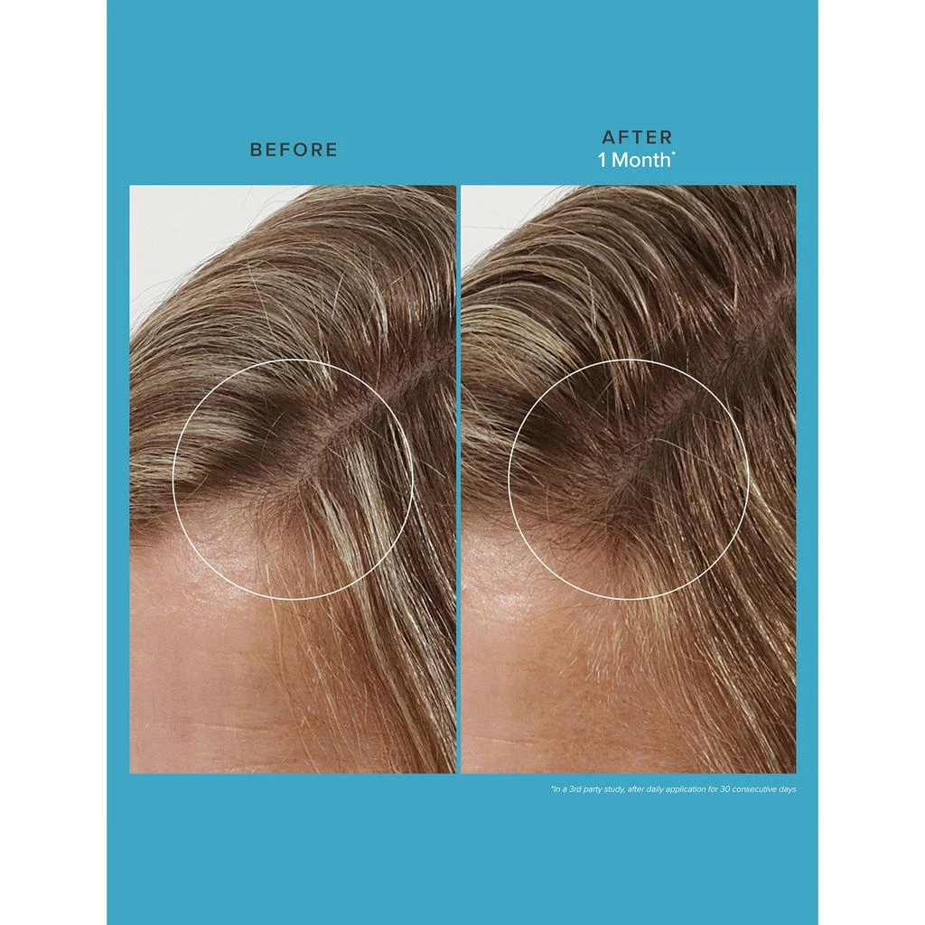 Living Proof Scalp Care Revitalizing Treatment 3