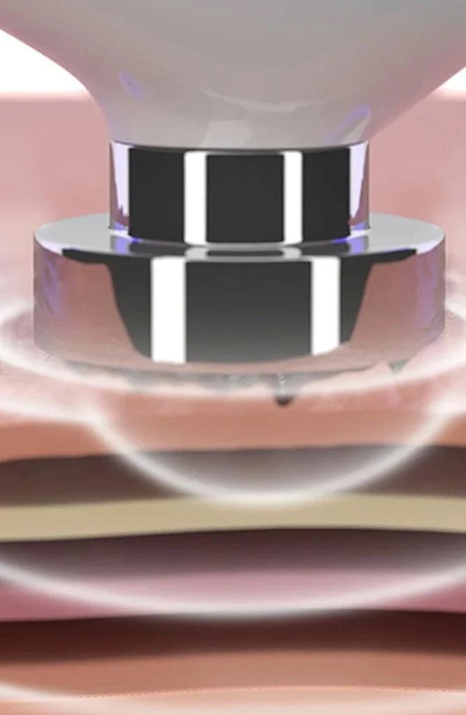 PURE DAILY CARE DermaWave Clinical Radio Frequency Skin Tightening Machine 2