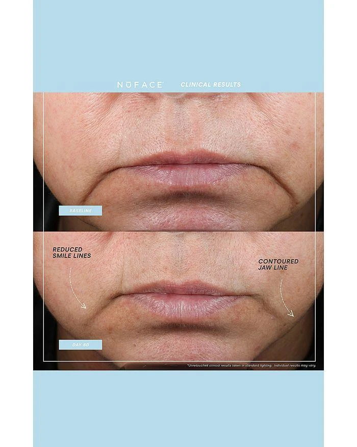 NuFace Mini+ Facial Toning Device & Primer - Black 6