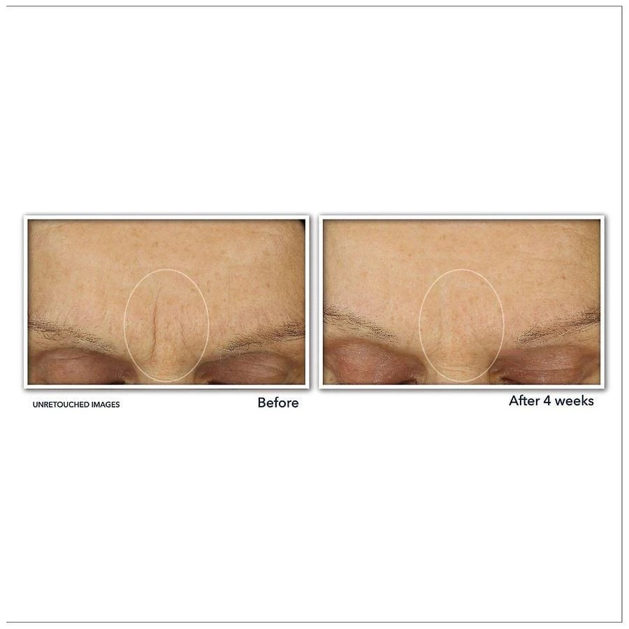 RoC Retinol Correxion Line Smoothing Max Hydration Cream 8
