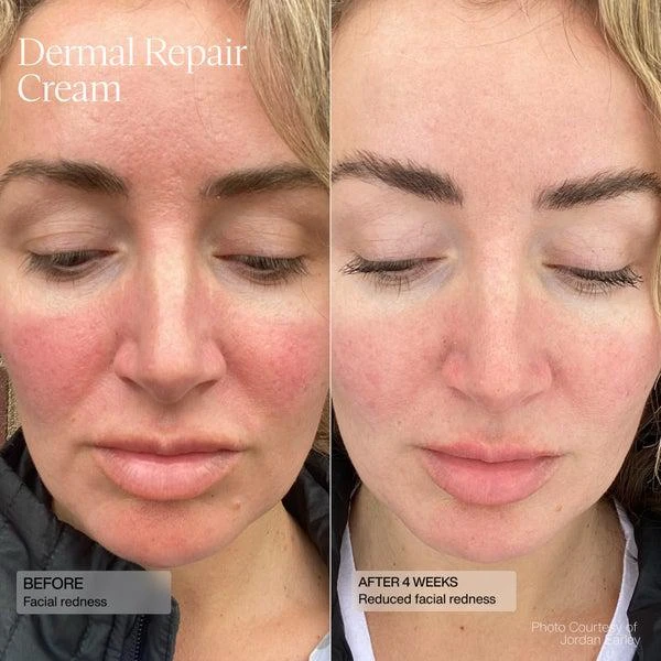 SENTÉ SENTÉ Renew and Brighten Duo 6
