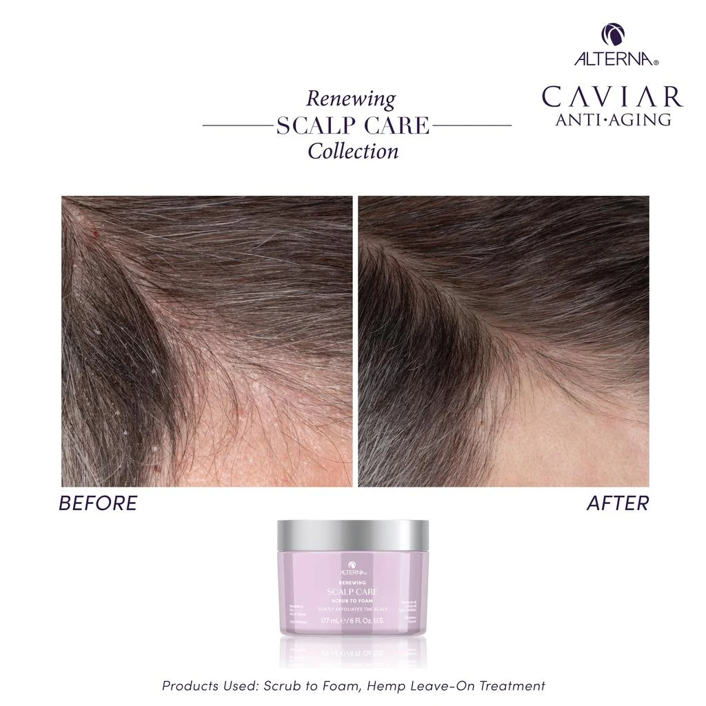 ALTERNA Alterna Renewing Scalp Care Scrub-to-Foam 6 oz 4