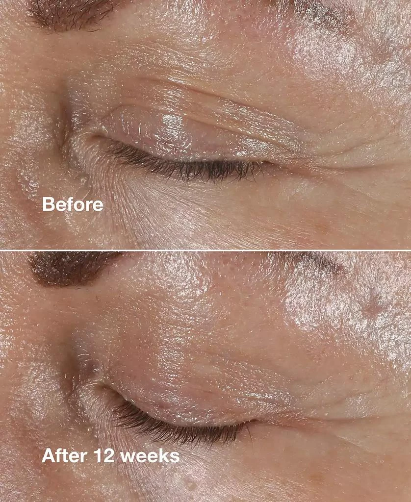 Clinique Smart Clinical Repair Wrinkle Correcting Eye Cream 4