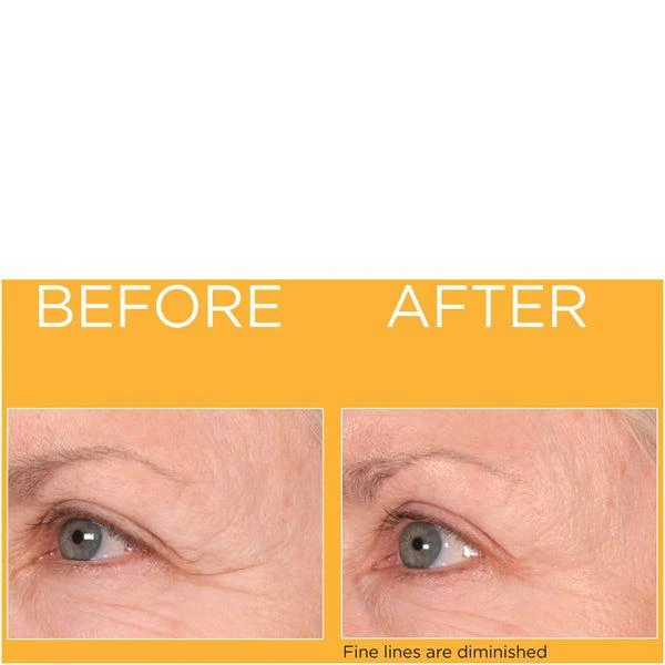 Elizabeth Arden Elizabeth Arden Prevage Progressive Renewal Treatment Exclusive 5