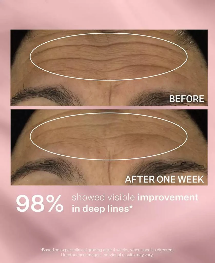 StriVectin Anti-Wrinkle Wrinkle Recode Serum, 1-oz. 6