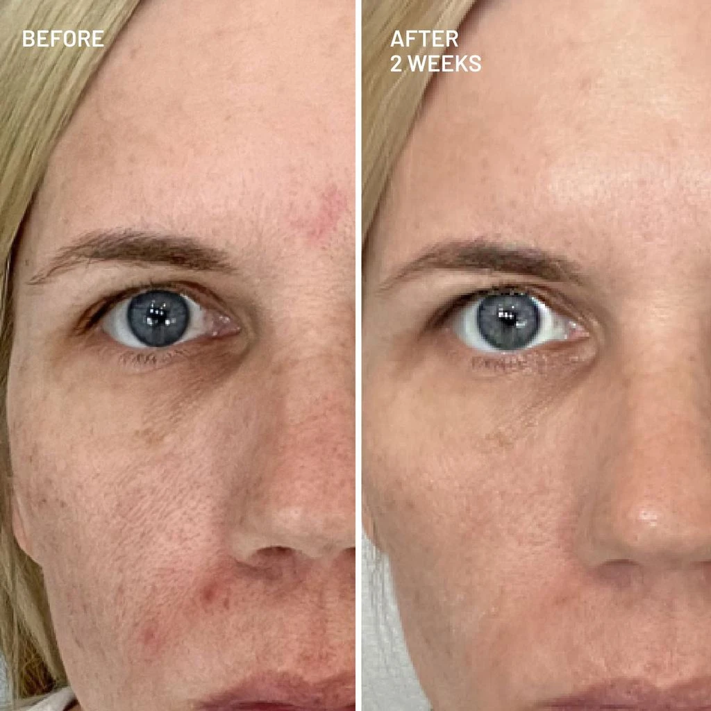 Dr. Brandt Skincare Advanced Pore Cleansing Duo 2