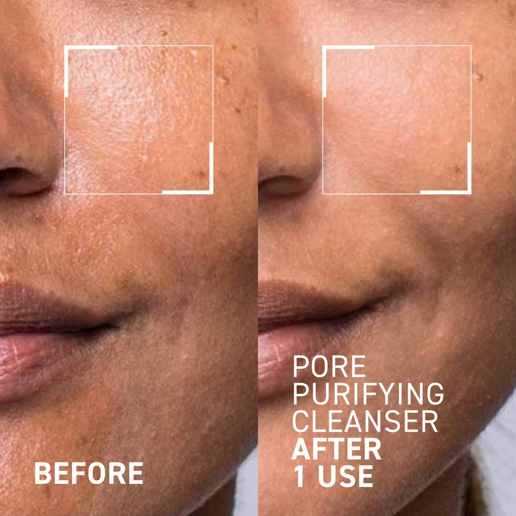 Dr. Brandt Skincare PORE PURIFYING CLEANSER