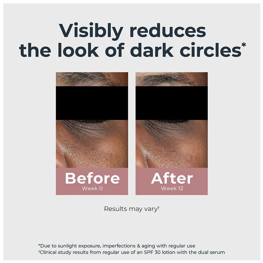 Eucerin Radiant Tone Eye Cream Dark Circle Corrector With Thiamidol And Hyaluronic Acid 2