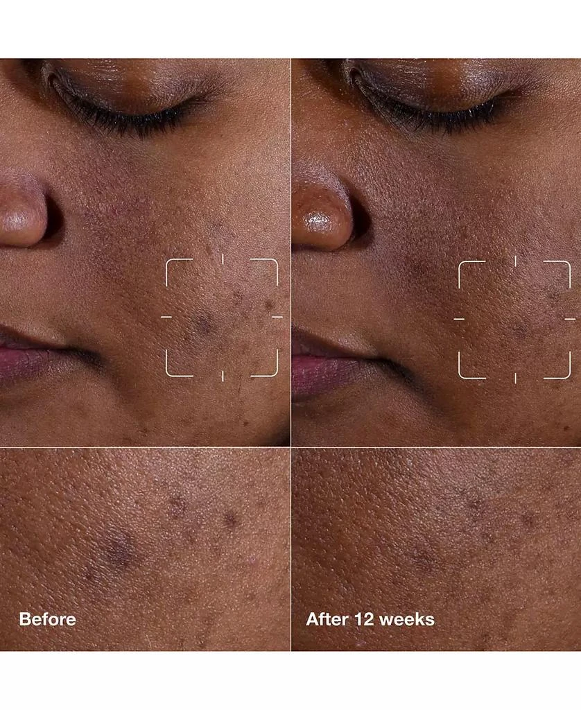 Clinique Even Better Clinical Dark Spot Clearing Serum with Vitamin C 4
