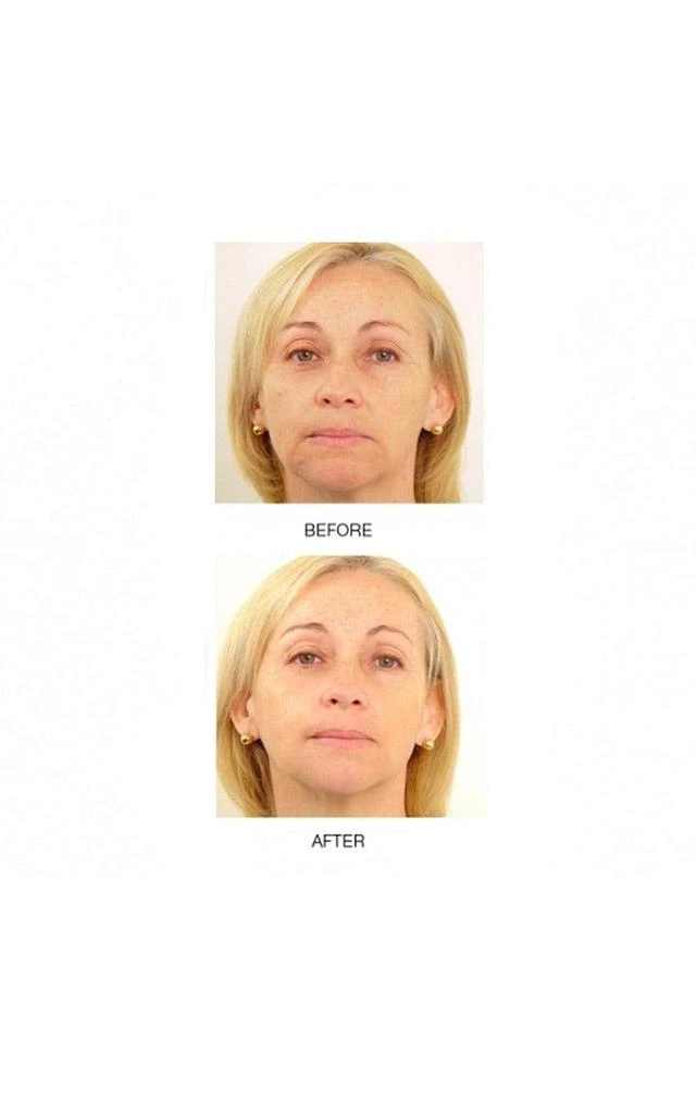 Mirenesse Power Lift Treatment Cream + FREE Multi Action 3-in-1 Silk Cleanser 3