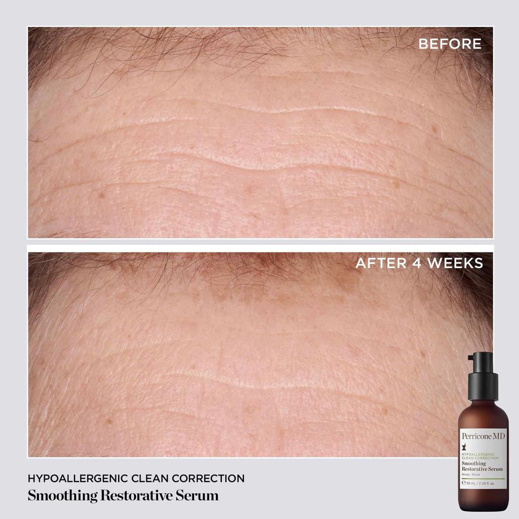 Perricone MD Hypoallergenic Clean Correction Smoothing Restorative Serum