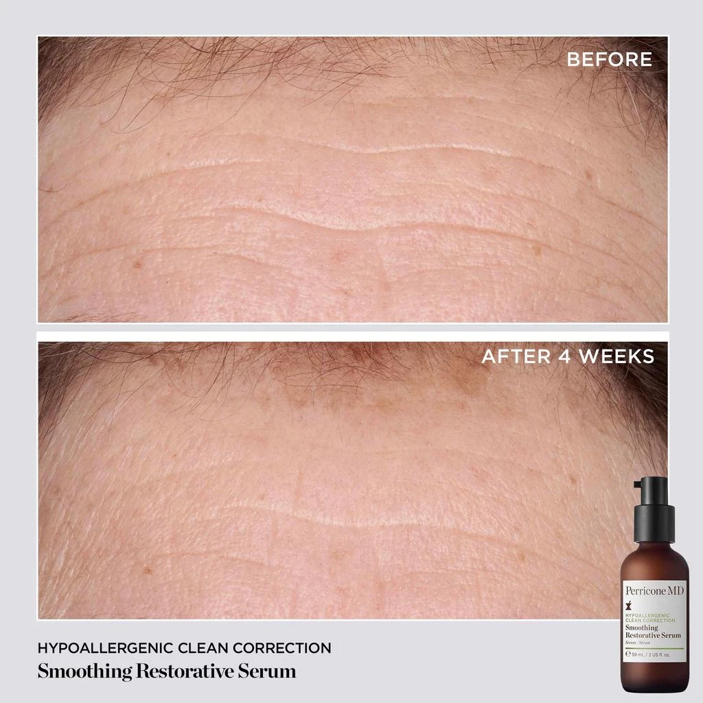 Perricone MD Hypoallergenic Clean Correction Smoothing Restorative Serum 2