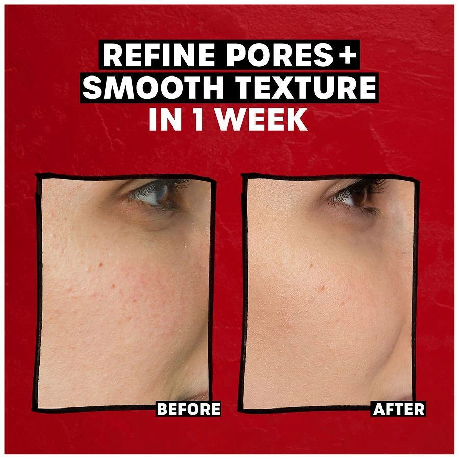 Thayers 2% AHA Pore Refining Toner 5