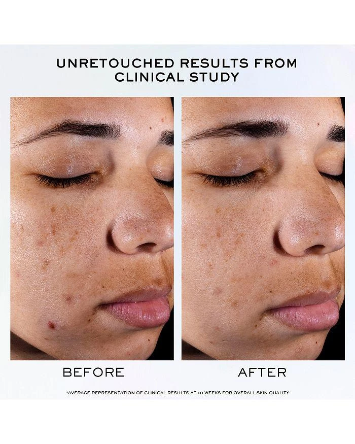Lancôme Clarifique Pro-Solution Brightening & Dark Spot Reducing Serum 9