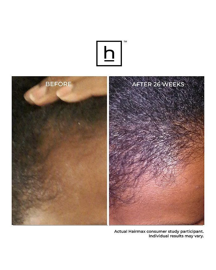 HairMax Ultima 12 Hair Growth LaserComb 7