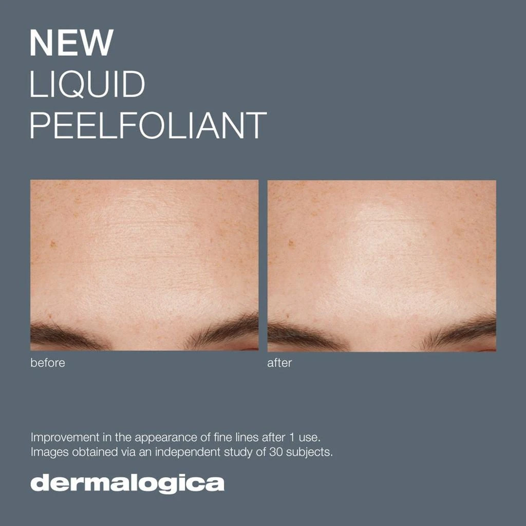 Dermalogica Liquid Peelfoliant 5