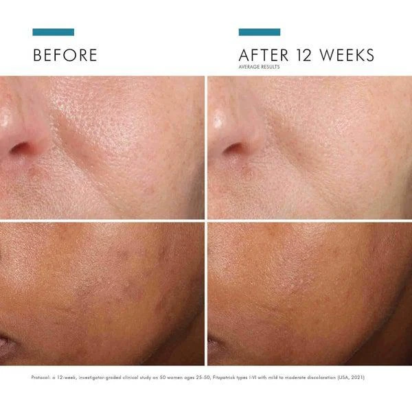 SkinCeuticals SkinCeuticals Phloretin CF with Ferulic Acid Vitamin C Serum 30ml 5
